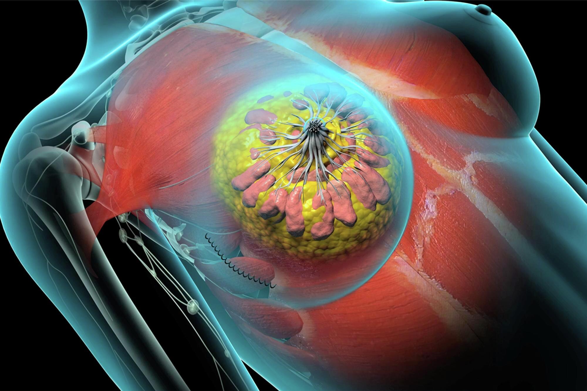 Breast & Endocrine Surgery